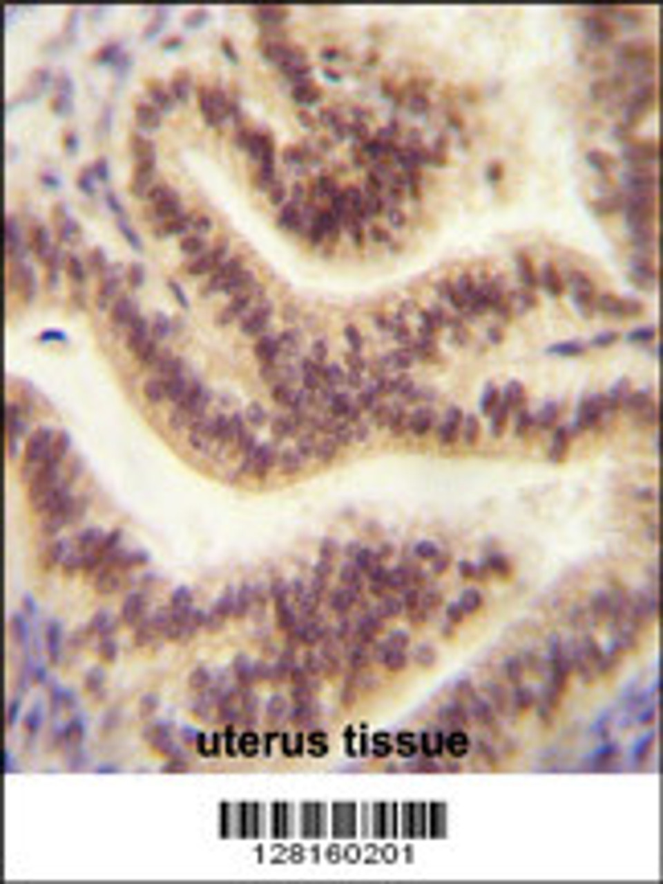 CP045 antibody immunohistochemistry analysis in formalin fixed and paraffin embedded human uterus tissue followed by peroxidase conjugation of the secondary antibody and DAB staining.