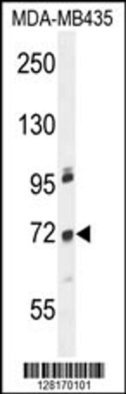 Western blot analysis in MDA-MB435 cell line lysates (35ug/lane) .