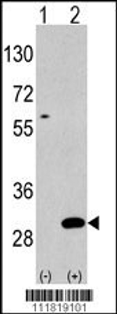 Western blot analysis of UBTD1 using rabbit polyclonal polyclonal antibody using 293 cell lysates (2 ug/lane) either nontransfected (Lane 1) or transiently transfected with the UBTD1 gene (Lane 2) .