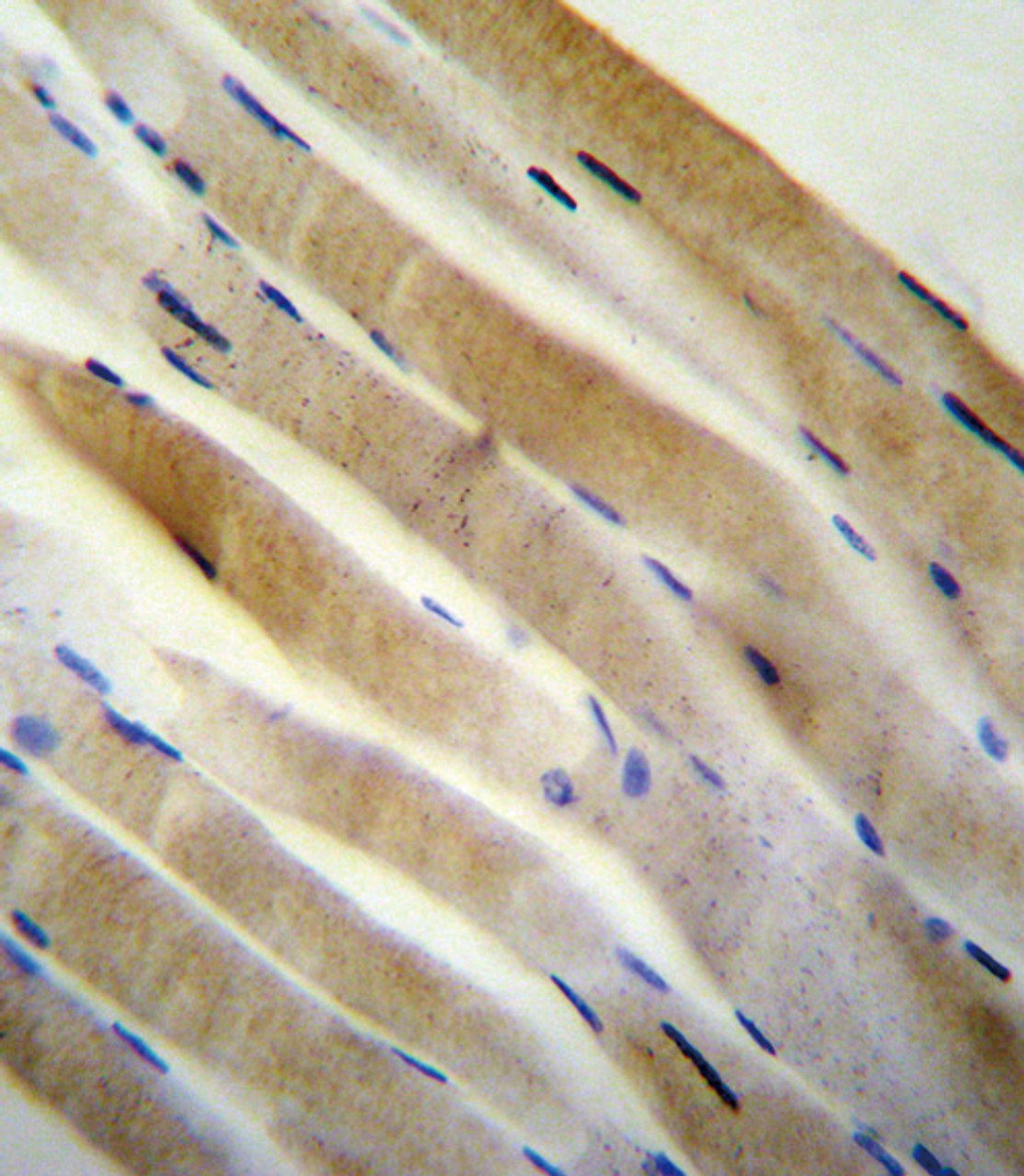 PRKAA2 (Thr172) antibody immunohistochemistry analysis in formalin fixed and paraffin embedded human skeletal muscle followed by peroxidase conjugation of the secondary antibody and DAB staining.This data demonstrates the use of the PRKAA2 (Thr172) antibody for immunohistochemistry.