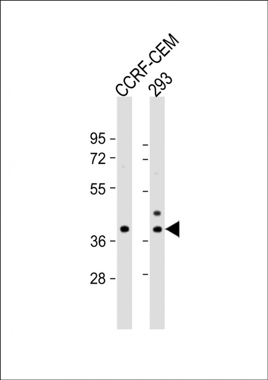 Western Blot at 1:1000 dilution Lane 1: CCRF-CEM whole cell lysate Lane 2: 293 whole cell lysate Lysates/proteins at 20 ug per lane.