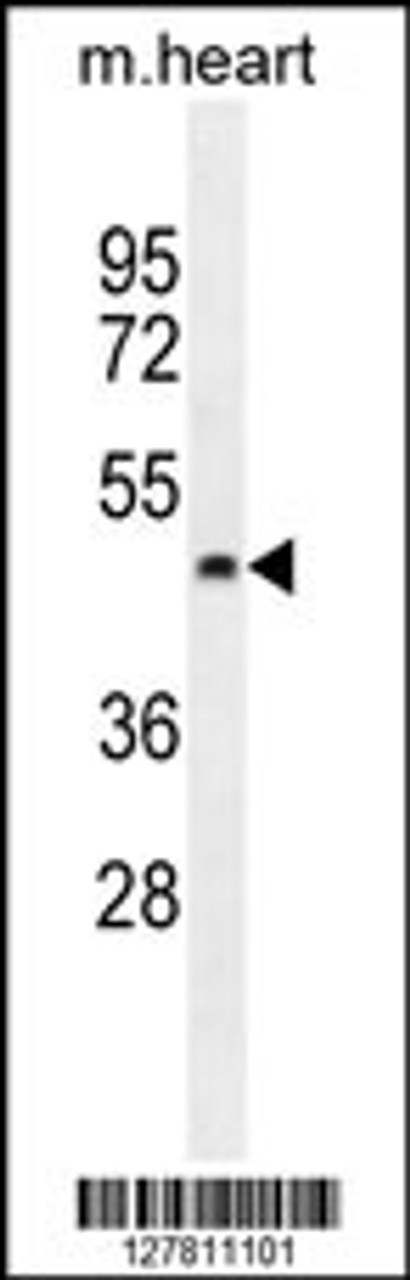 Western blot analysis in mouse heart tissue lysates (35ug/lane) .