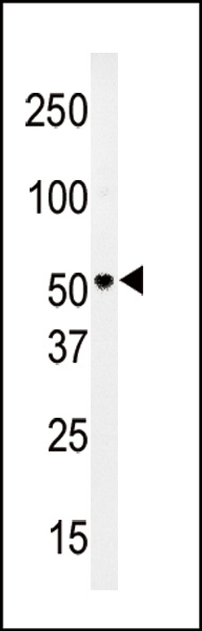 Western blot analysis of anti-PMAT (Slc29a4) Antibody in HepG2 cell line lysates (35ug/lane)