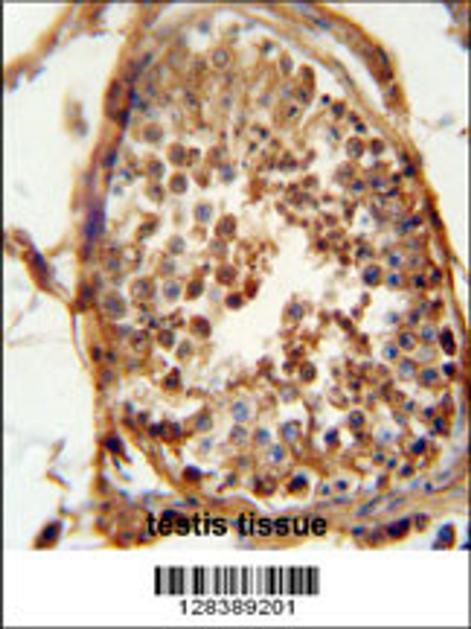 DNAJB13 antibody immunohistochemistry analysis in formalin fixed and paraffin embedded human testis carcinoma followed by peroxidase conjugation of the secondary antibody and DAB staining.