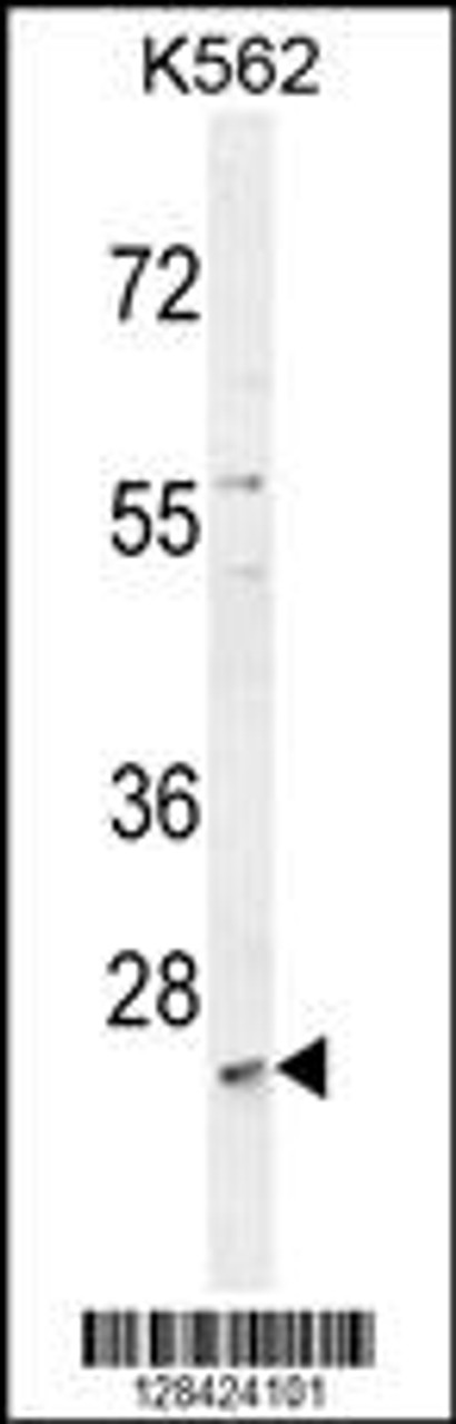 Western blot analysis in K562 cell line lysates (35ug/lane) .