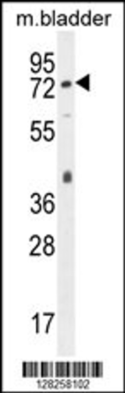 Western blot analysis in mouse bladder tissue lysates (35ug/lane) .This demonstrates thedetected the MouseCD31 protein (arrow) .