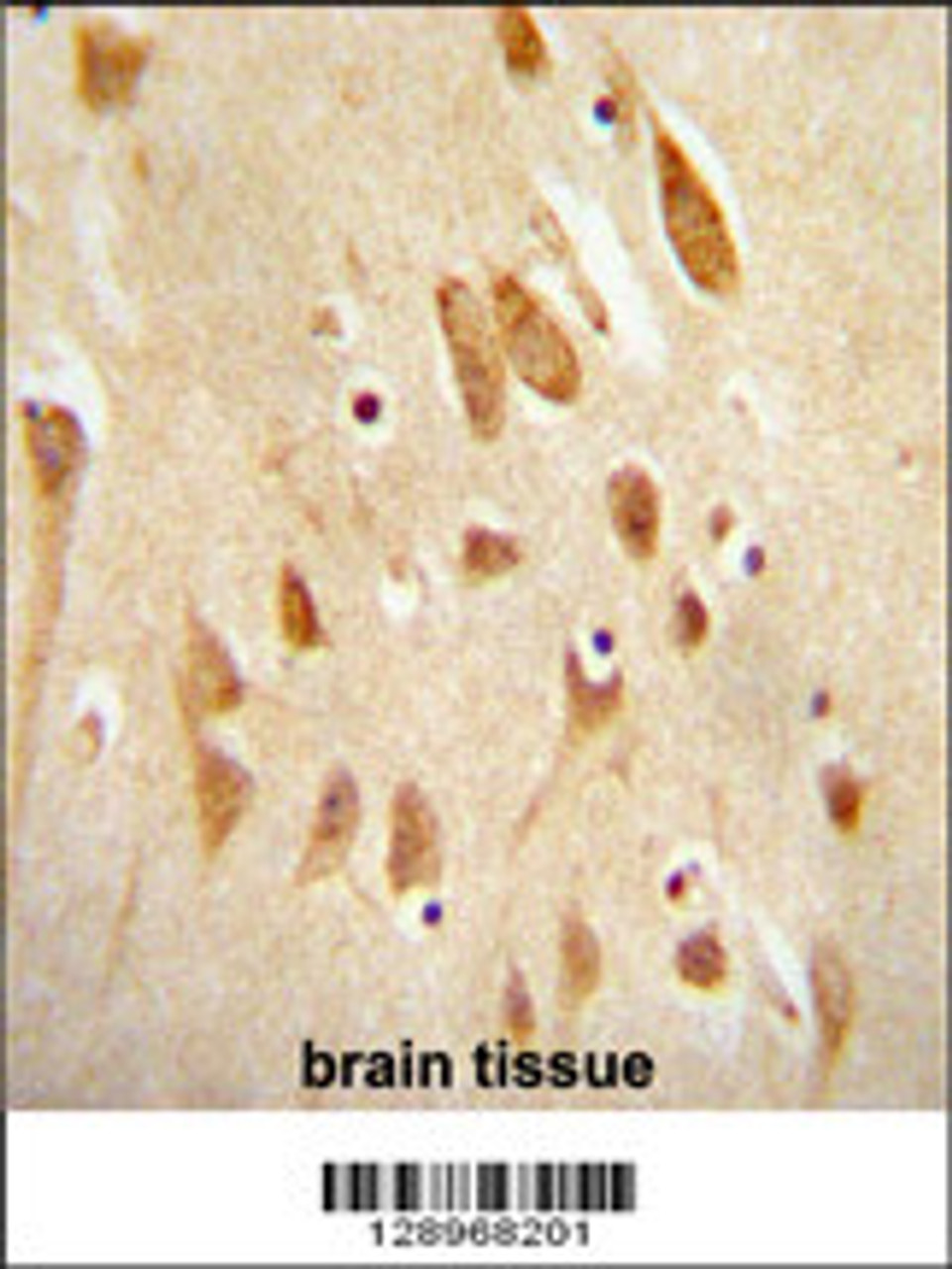 JNK1-T183/Y185 antibody immunohistochemistry analysis in formalin fixed and paraffin embedded human brain tissue followed by peroxidase conjugation of the secondary antibody and DAB staining. This data demonstrates the use of the LJNK1-T183/Y185 antibody for immunohistochemistry.