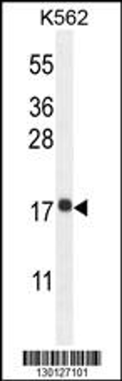 Western blot analysis in K562 cell line lysates (35ug/lane) .