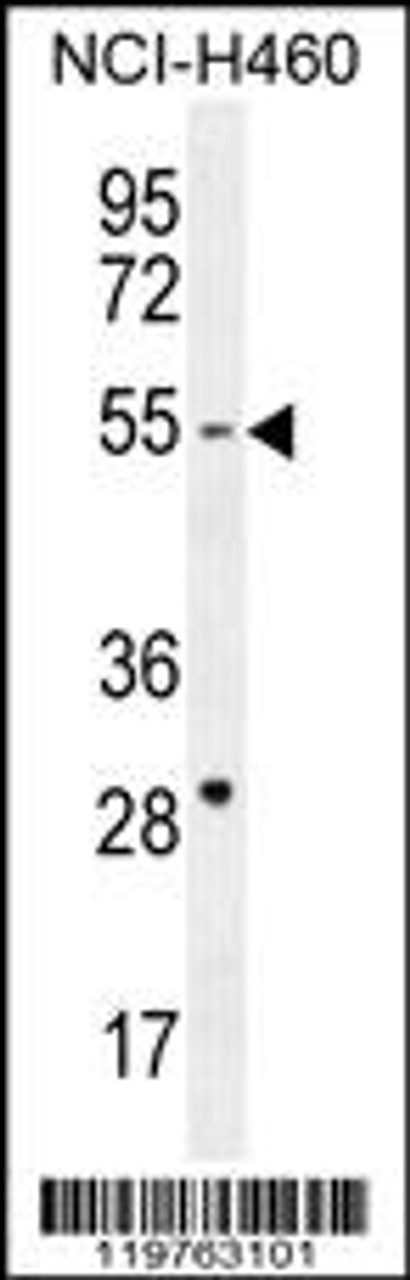 Western blot analysis in NCI-H460 cell line lysates (35ug/lane) .