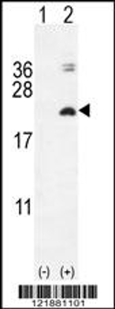 Western blot analysis of IL17F using rabbit polyclonal IL17F Antibody using 293 cell lysates (2 ug/lane) either nontransfected (Lane 1) or transiently transfected with the IL17F gene (Lane 2) .
