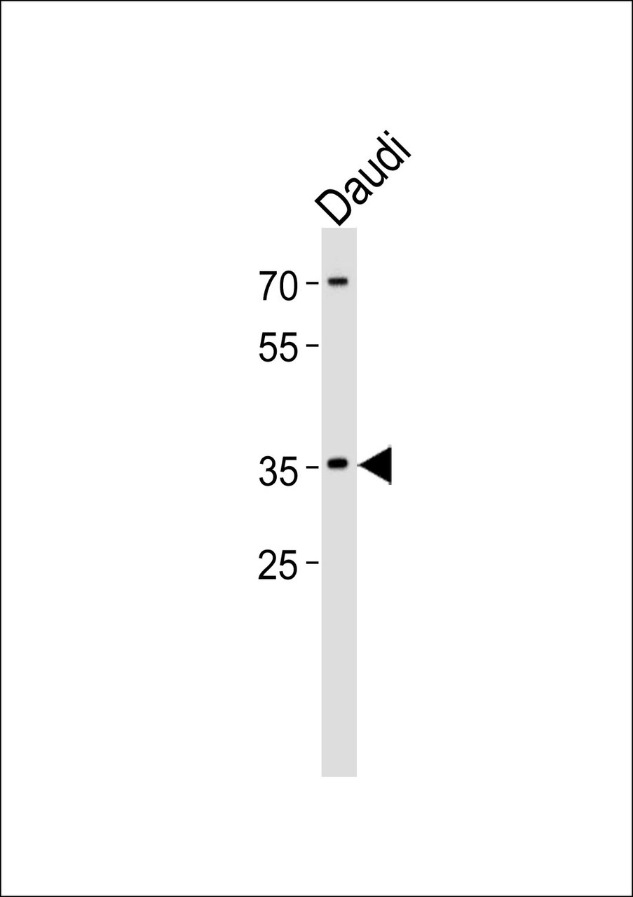 Western blot analysis of lysate from Daudi cell line, using FOSL2 Antibody at 1:1000.