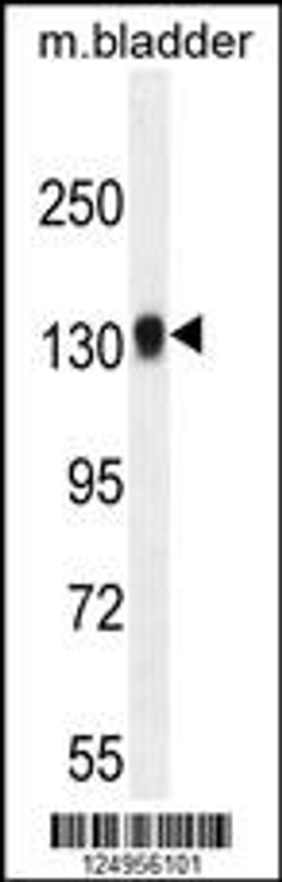 Western blot analysis in mouse bladder tissue lysates (35ug/lane) .