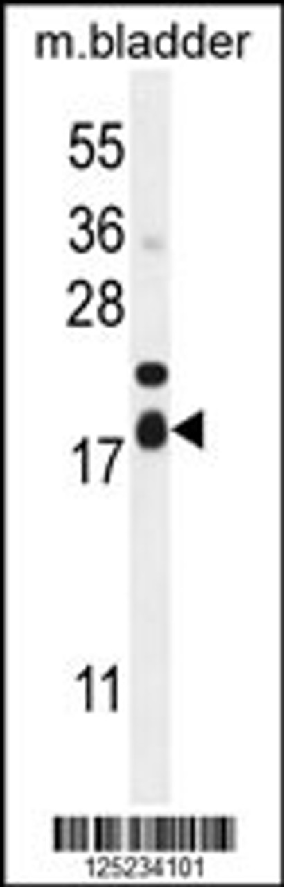 Western blot analysis in mouse bladder tissue lysates (35ug/lane) .