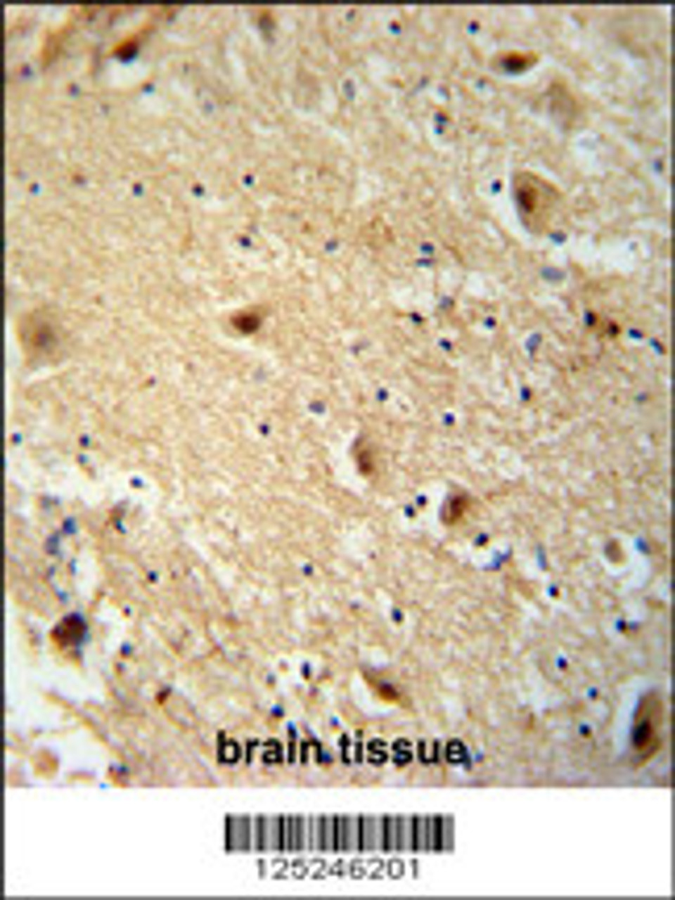 TBC14 antibody immunohistochemistry analysis in formalin fixed and paraffin embedded human brain tissie followed by peroxidase conjugation of the secondary antibody and DAB staining.
