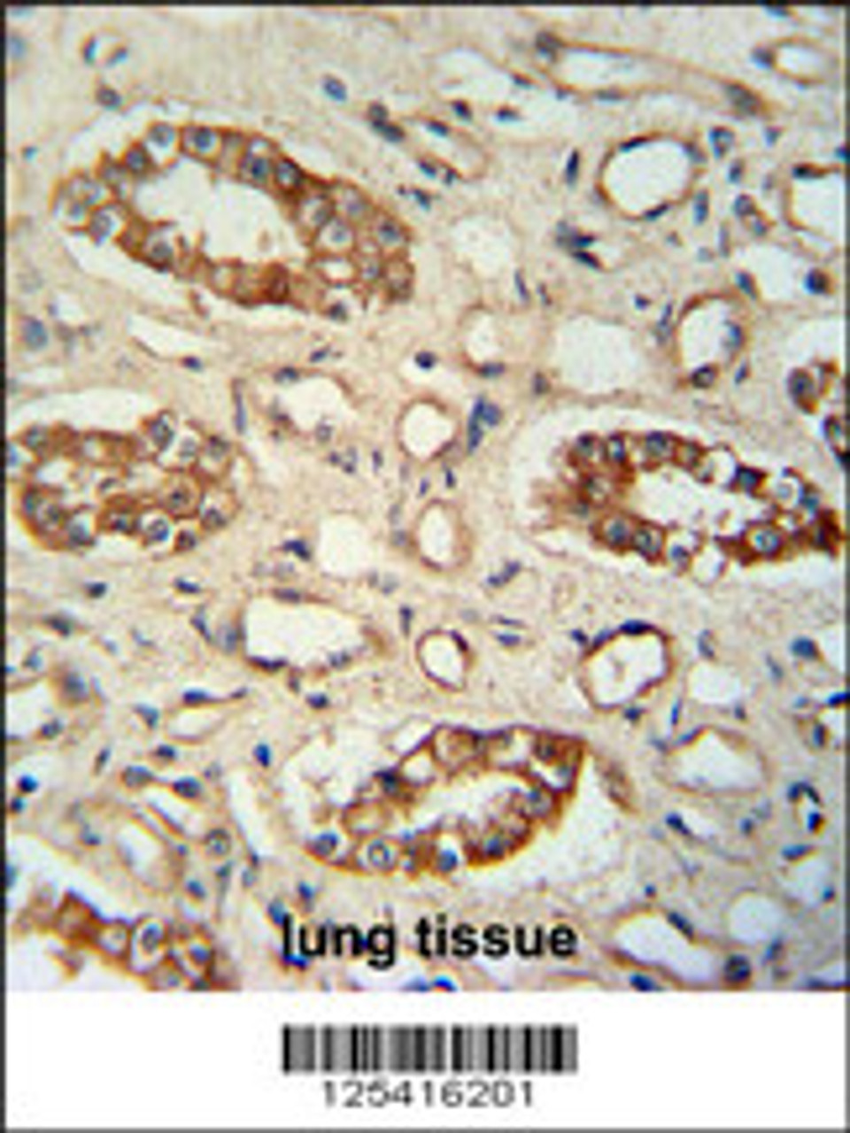 PPM1L antibody immunohistochemistry analysis in formalin fixed and paraffin embedded human lung tissue followed by peroxidase conjugation of the secondary antibody and DAB staining.