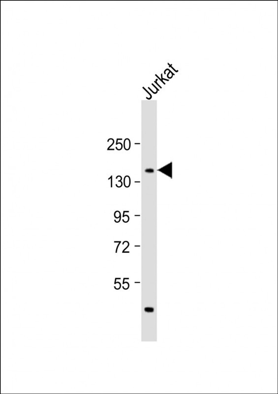 Western Blot at 1:1000 dilution + Jurkat whole cell lysate Lysates/proteins at 20 ug per lane.