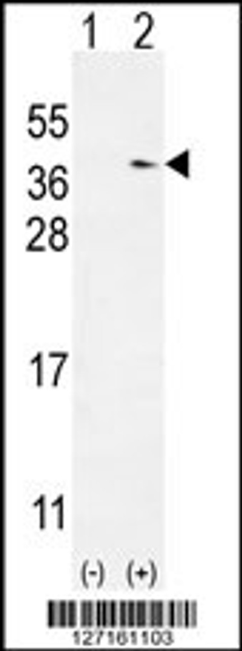 Western blot analysis of TXNDC6 using rabbit polyclonal TXNDC6 Antibody using 293 cell lysates (2 ug/lane) either nontransfected (Lane 1) or transiently transfected (Lane 2) with the TXNDC6 gene.