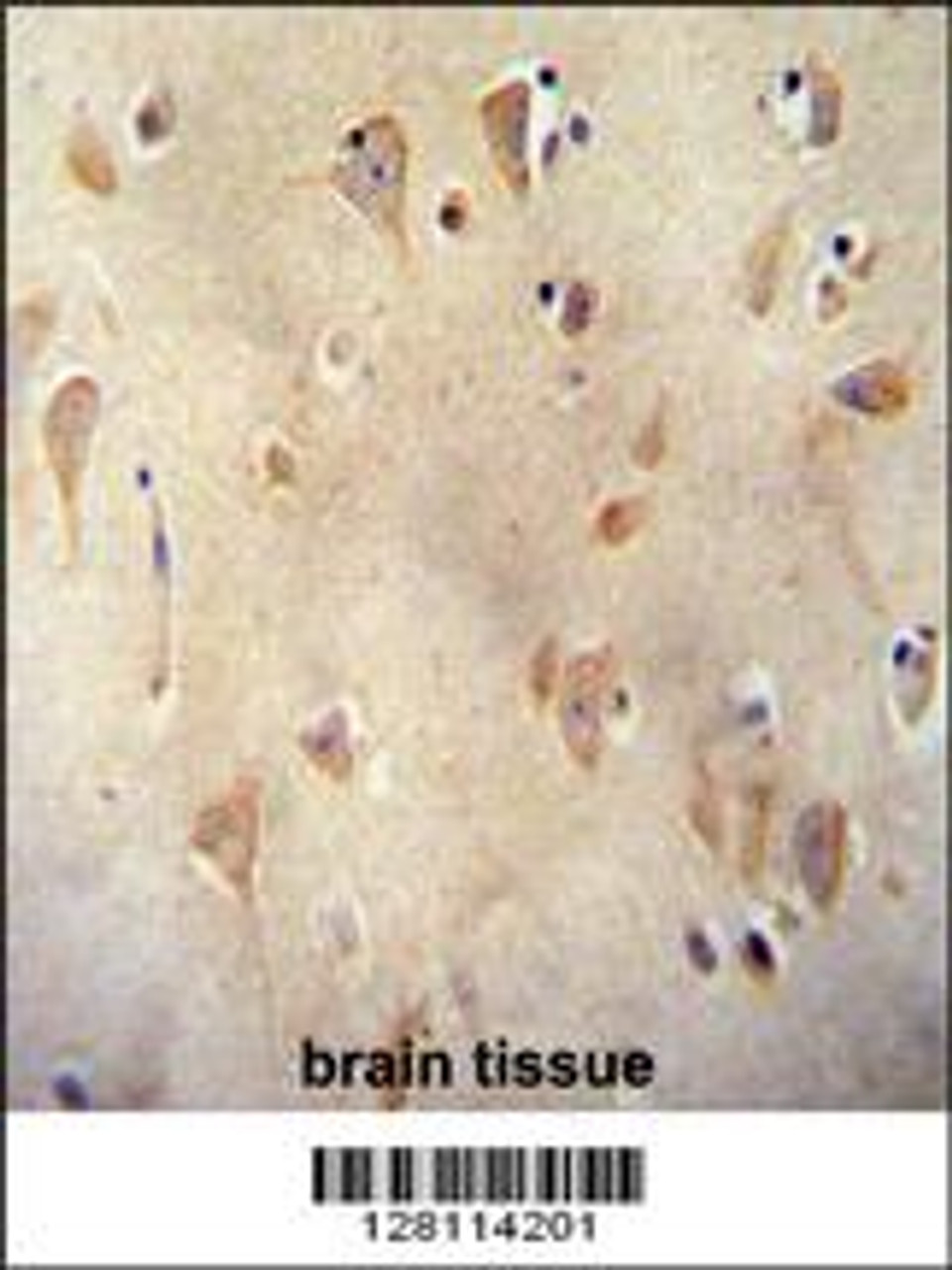 LRC40 antibody immunohistochemistry analysis in formalin fixed and paraffin embedded human brain tissue followed by peroxidase conjugation of the secondary antibody and DAB staining.