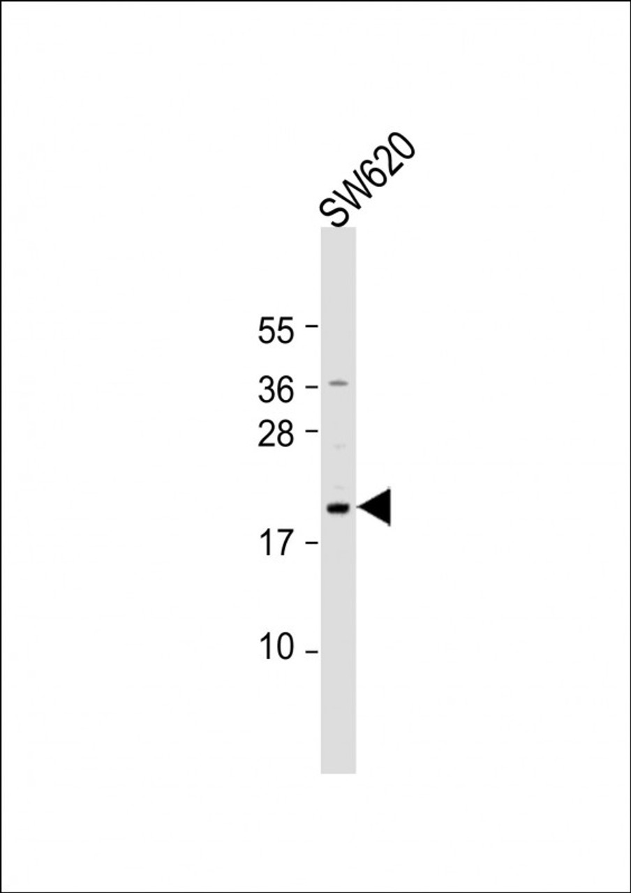 Western Blot at 1:1000 dilution + SW620 whole cell lysate Lysates/proteins at 20 ug per lane.