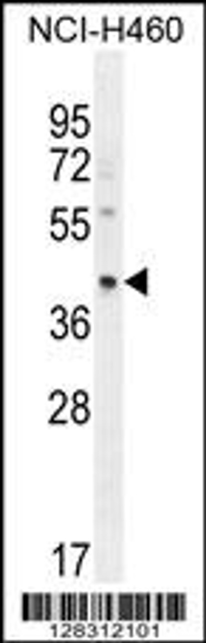 Western blot analysis in NCI-H460 cell line lysates (35ug/lane) .