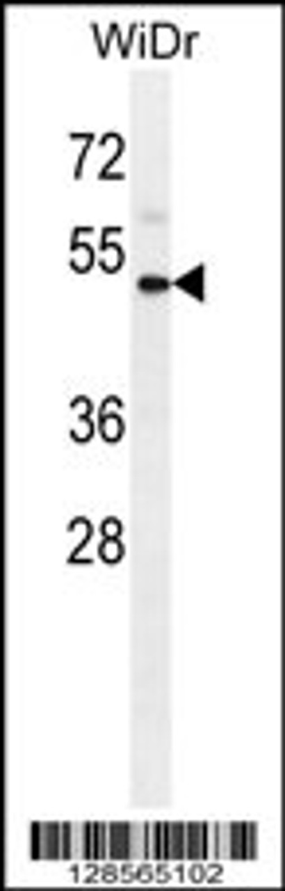 Western blot analysis in WiDr cell line lysates (35ug/lane) .