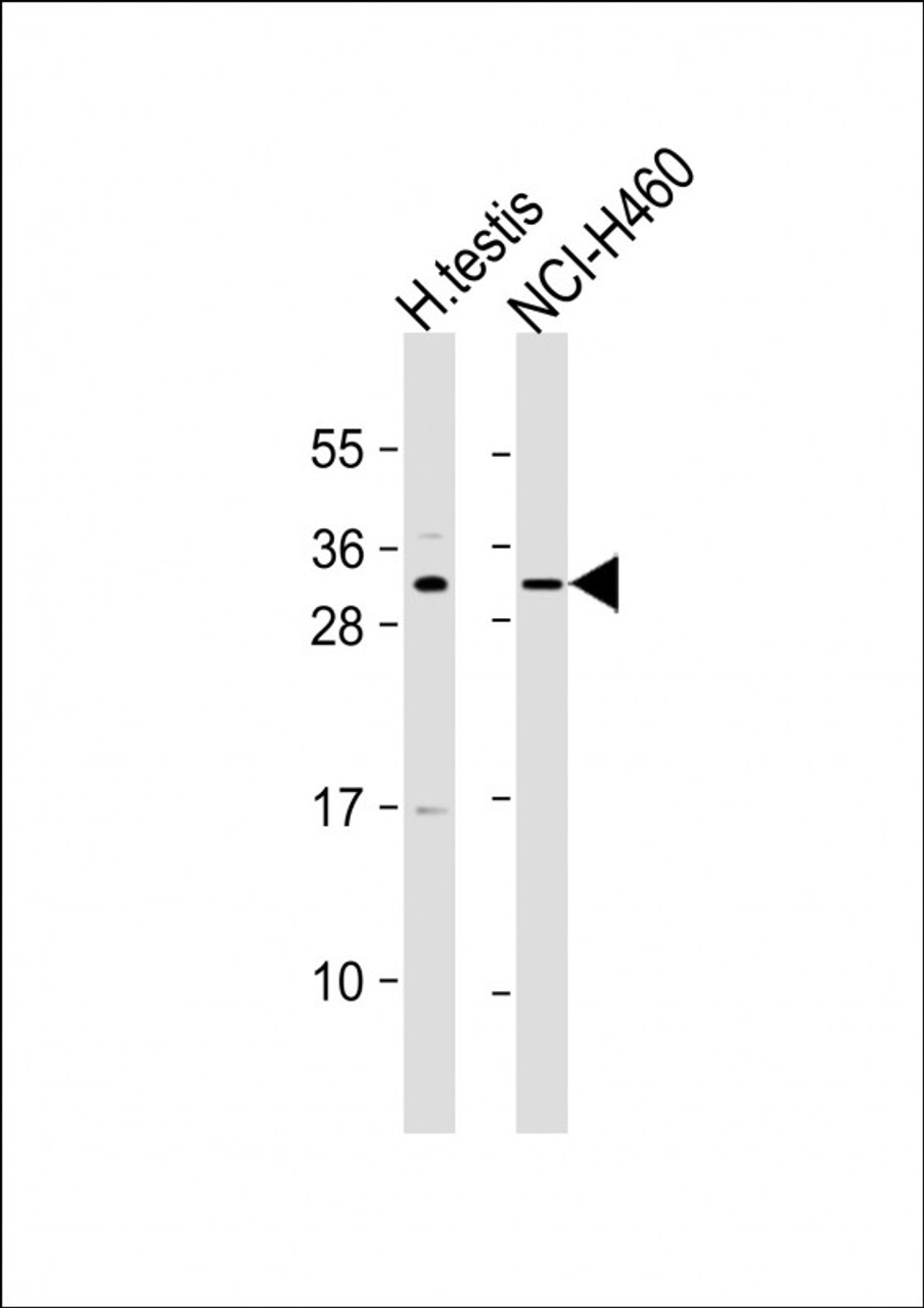 Western Blot at 1:1000 dilution Lane 1: human testis lysate Lane 2: NCI-H460 whole cell lysate Lysates/proteins at 20 ug per lane.