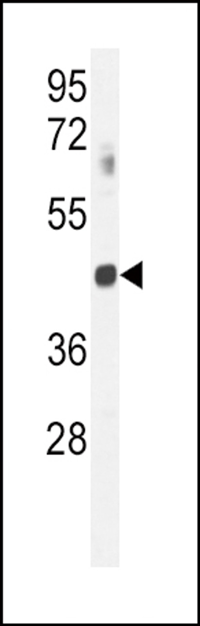 Western blot analysis in mouse spleen tissue lysates (35ug/lane) .