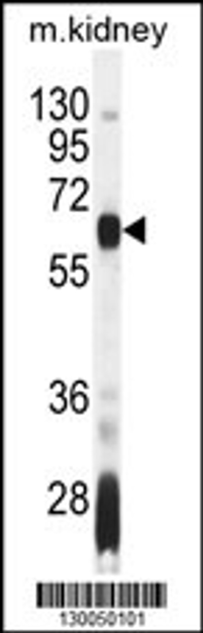 Western blot analysis in mouse kidney tissue lysates (35ug/lane) .