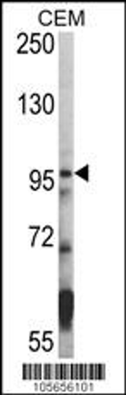 Western blot analysis of hHDAC7-A935 in CEM cell line lysates (35ug/lane)