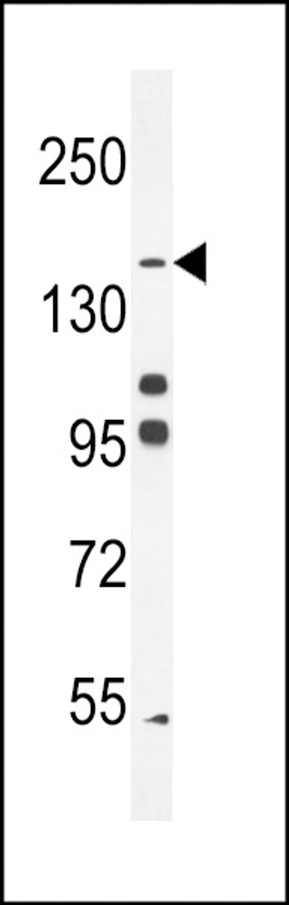 Western blot analysis in K562 cell line lysates (35ug/lane) .This demonstrates the DEP-1 antibody detected the DEP-1 protein (arrow) .