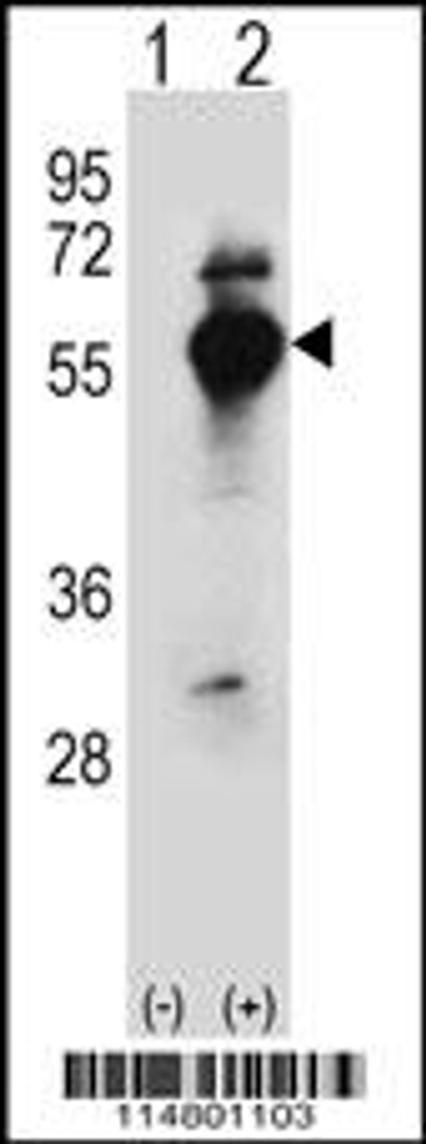 Western blot analysis of DARS using rabbit polyclonal DARS Antibody using 293 cell lysates (2 ug/lane) either nontransfected (Lane 1) or transiently transfected (Lane 2) with the DARS gene.