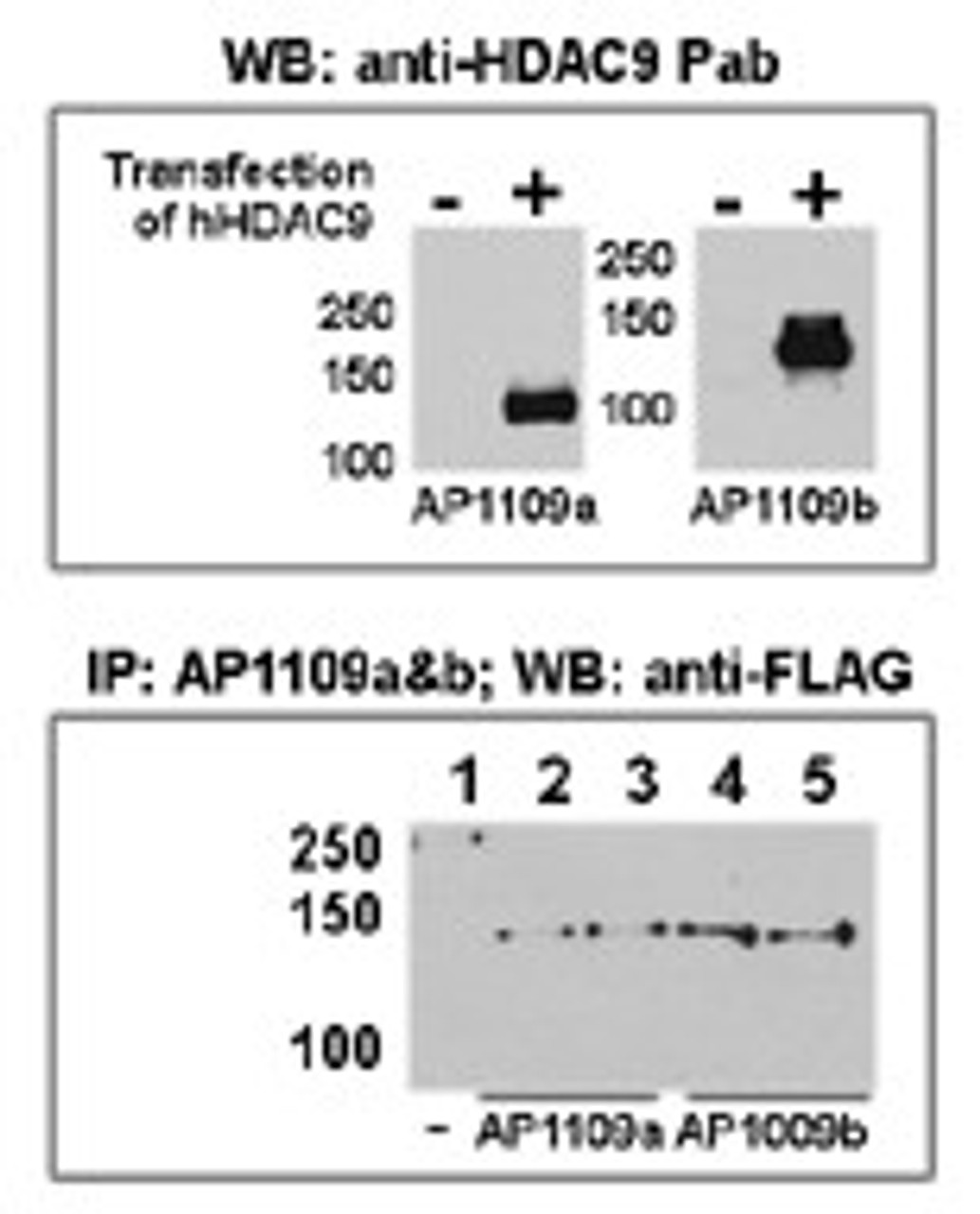 Both anti-HDAC9 N-term and C-term Pab were tested by WB and IP-WB using HeLa and HeLa-HDAC9 transfected cells. Top figure shows both Pab specifically detect HDAC9 in HeLa-HDAC9 transfected cell but not HeLa alone. Bottom figure shows that both Pab can immunoprecipitate (IP) HDAC9 from HeLa-HDAC9 tranfected cells. (Data kindly provided by Dr. Zhigang Yuan, H. Lee Moffitt Cancer Center and Research Institute, Tampa, FL) .