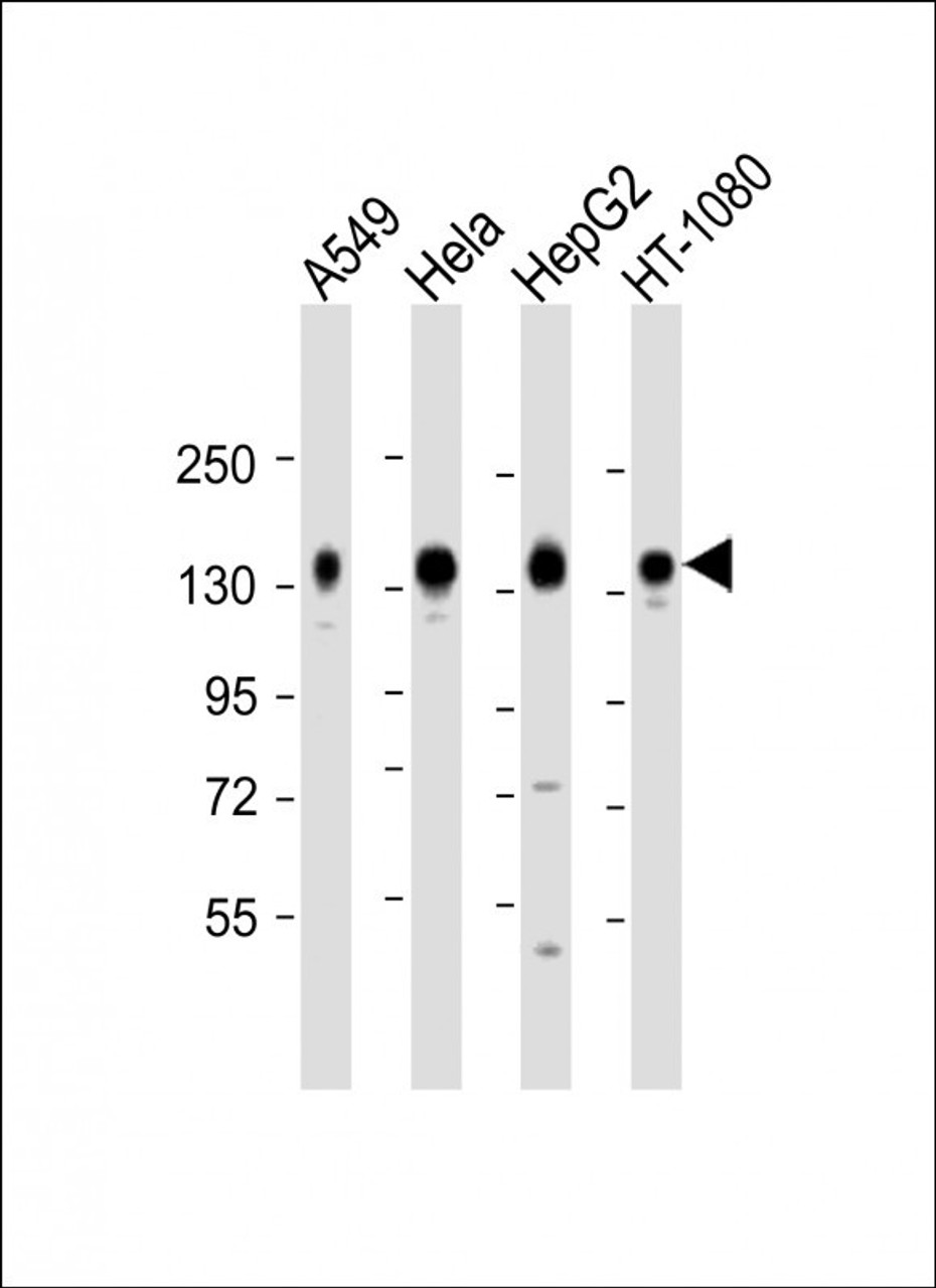 Western Blot at 1:2000 dilution Lane 1: A549 whole cell lysate Lane 2: Hela whole cell lysate Lane 3: HepG2 whole cell lysate Lane 4: HT-1080 whole cell lysate Lysates/proteins at 20 ug per lane.