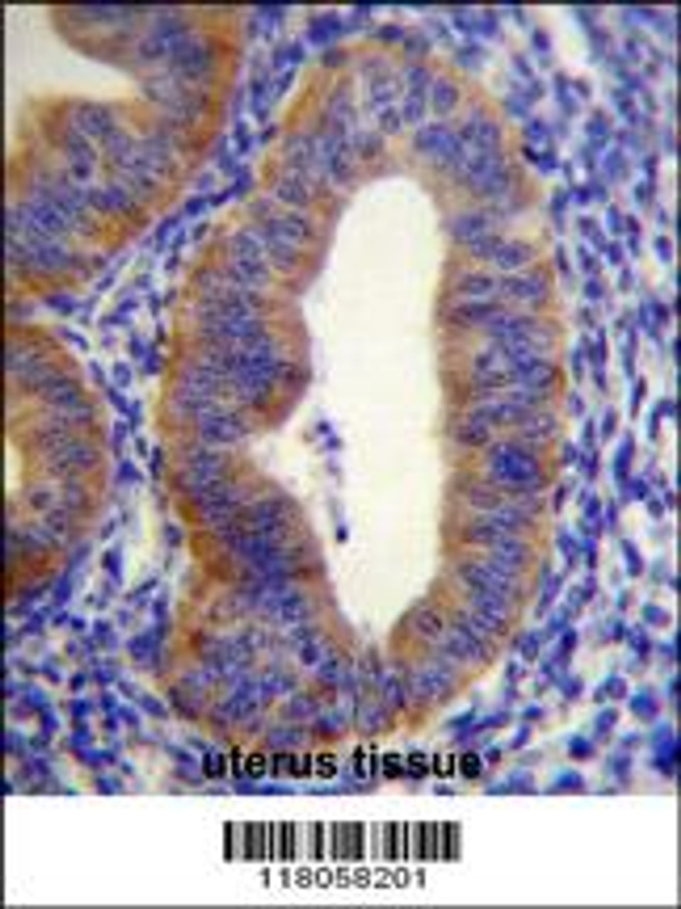 FGD6 Antibody immunohistochemistry analysis in formalin fixed and paraffin embedded human uterus tissue followed by peroxidase conjugation of the secondary antibody and DAB staining.