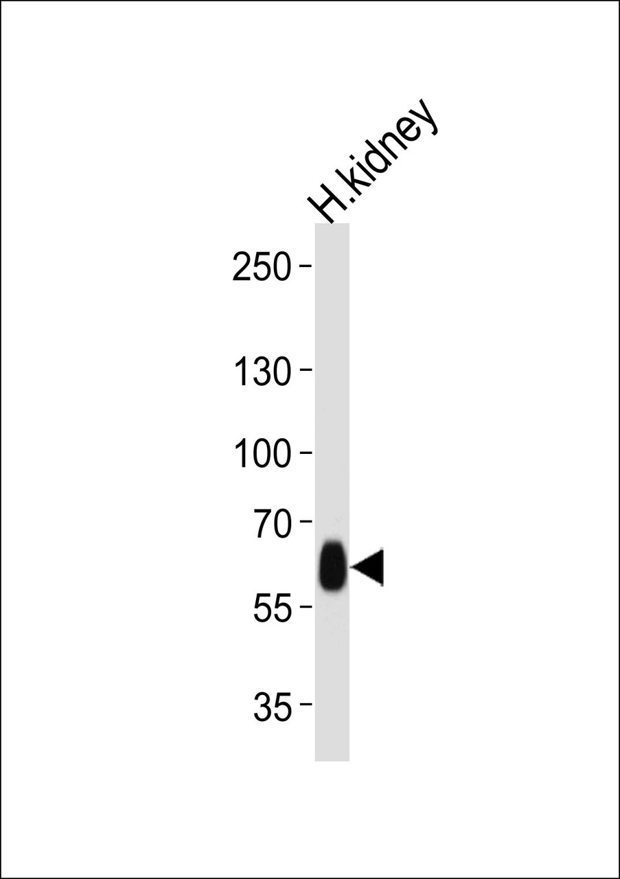 Western blot analysis of lysate from human kidney tissue lysate, using DFNB31 Antibody at 1:1000 at each lane.