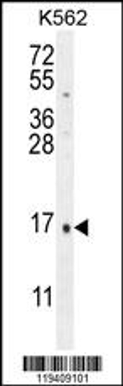 Western blot analysis in K562 cell line lysates (35ug/lane) .