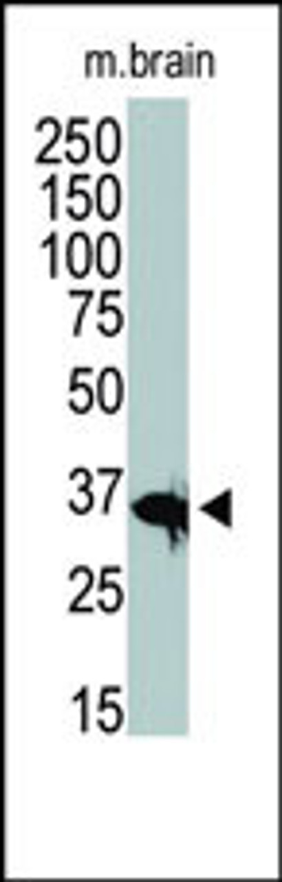 Antibody is used in Western blot to detect HDAC11 in mouse brain tissue lysate.