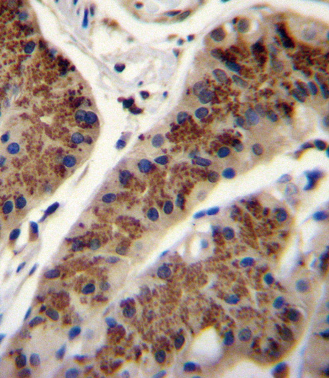 INHBA Antibody immunohistochemistry analysis in formalin fixed and paraffin embedded human stomach tissue followed by peroxidase conjugation of the secondary antibody and DAB staining.
