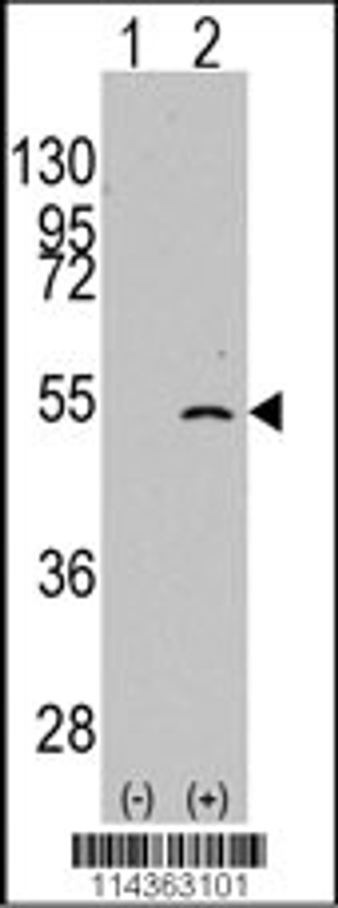 Western blot analysis of ELP3 using rabbit polyclonal ELP3 Antibody.293 cell lysates (2 ug/lane) either nontransfected (Lane 1) or transiently transfected with the ELP3 gene (Lane 2) .