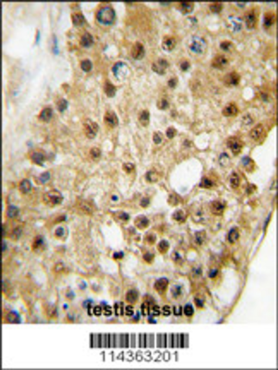 Formalin-fixed and paraffin-embedded human testis tissue reacted with ELP3 antibody, which was peroxidase-conjugated to the secondary antibody, followed by DAB staining.