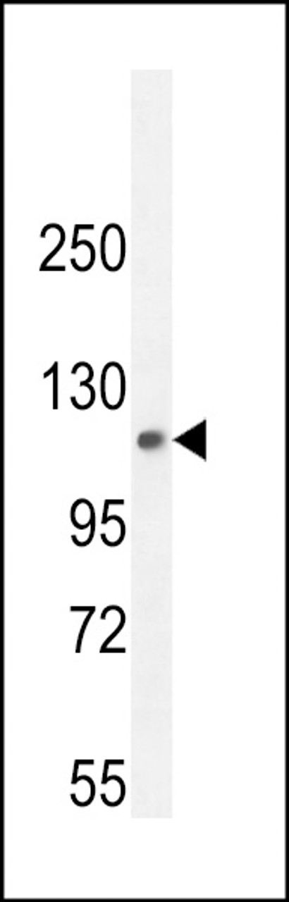 Western blot analysis in mouse lung tissue lysates (35ug/lane) .