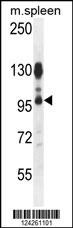 Western blot analysis in mouse spleen tissue lysates (35ug/lane) .