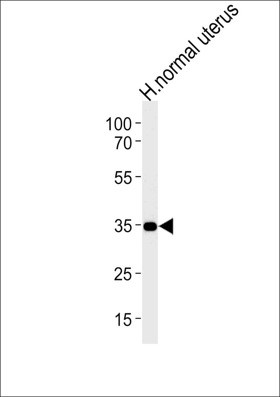 Western blot analysis in human normal uterus tissue lysates (35ug/lane) .