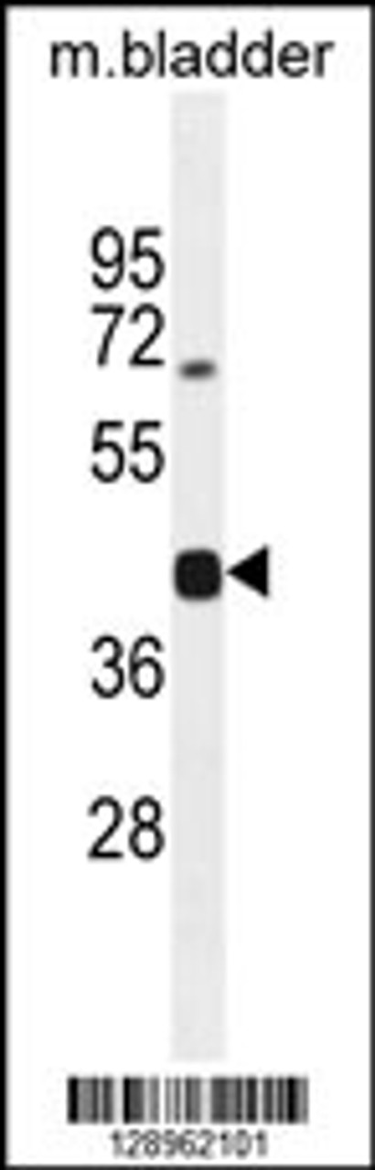 Western blot analysis in mouse bladder tissue lysates (35ug/lane) .