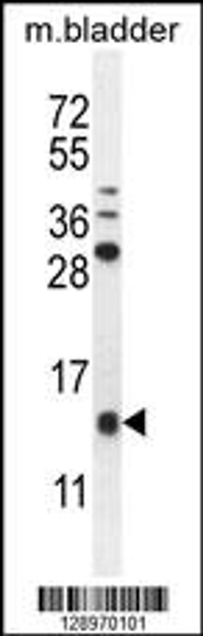 Western blot analysis in mouse bladder tissue lysates (35ug/lane) .