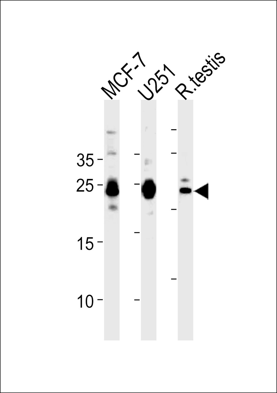 Western blot analysis in MCF-7, U251 cell line and rat testis tissue lysates (35ug/lane) .