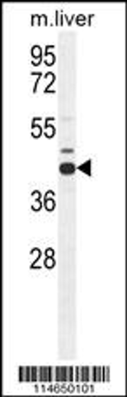 Western blot analysis in mouse liver tissue lysates (35ug/lane) .