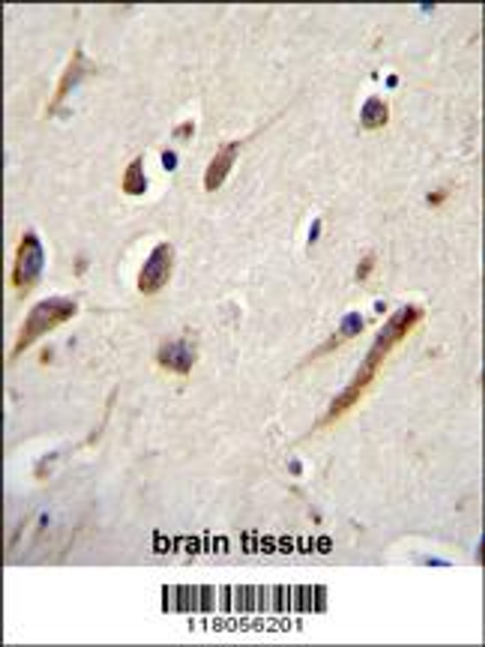 FBXW11 Antibody immunohistochemistry analysis in formalin fixed and paraffin embedded human brain tissue followed by peroxidase conjugation of the secondary antibody and DAB staining.