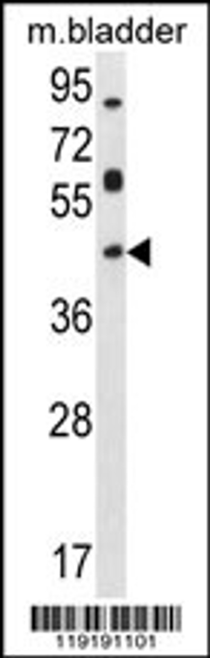 Western blot analysis in mouse bladder tissue lysates (35ug/lane) .