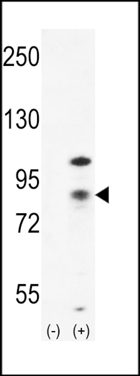 Western blot analysis of CTNB1 using rabbit polyclonal CTNB1 Antibody using 293 cell lysates (2 ug/lane) either nontransfected (Lane 1) or transiently transfected (Lane 2) with the CTNB1 gene.